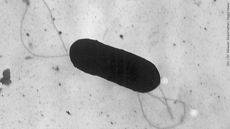 CDC investigating listeria outbreak possibly linked to meats, cheeses